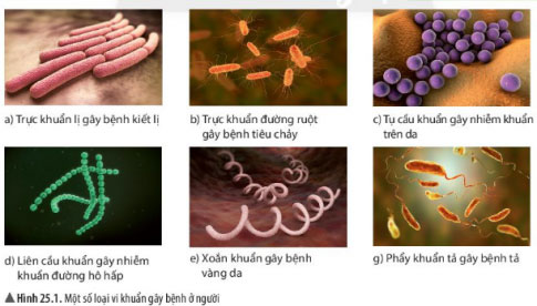 Khoa học tự nhiên 6 Bài 25: Vi khuẩn - Chân trời sáng tạo